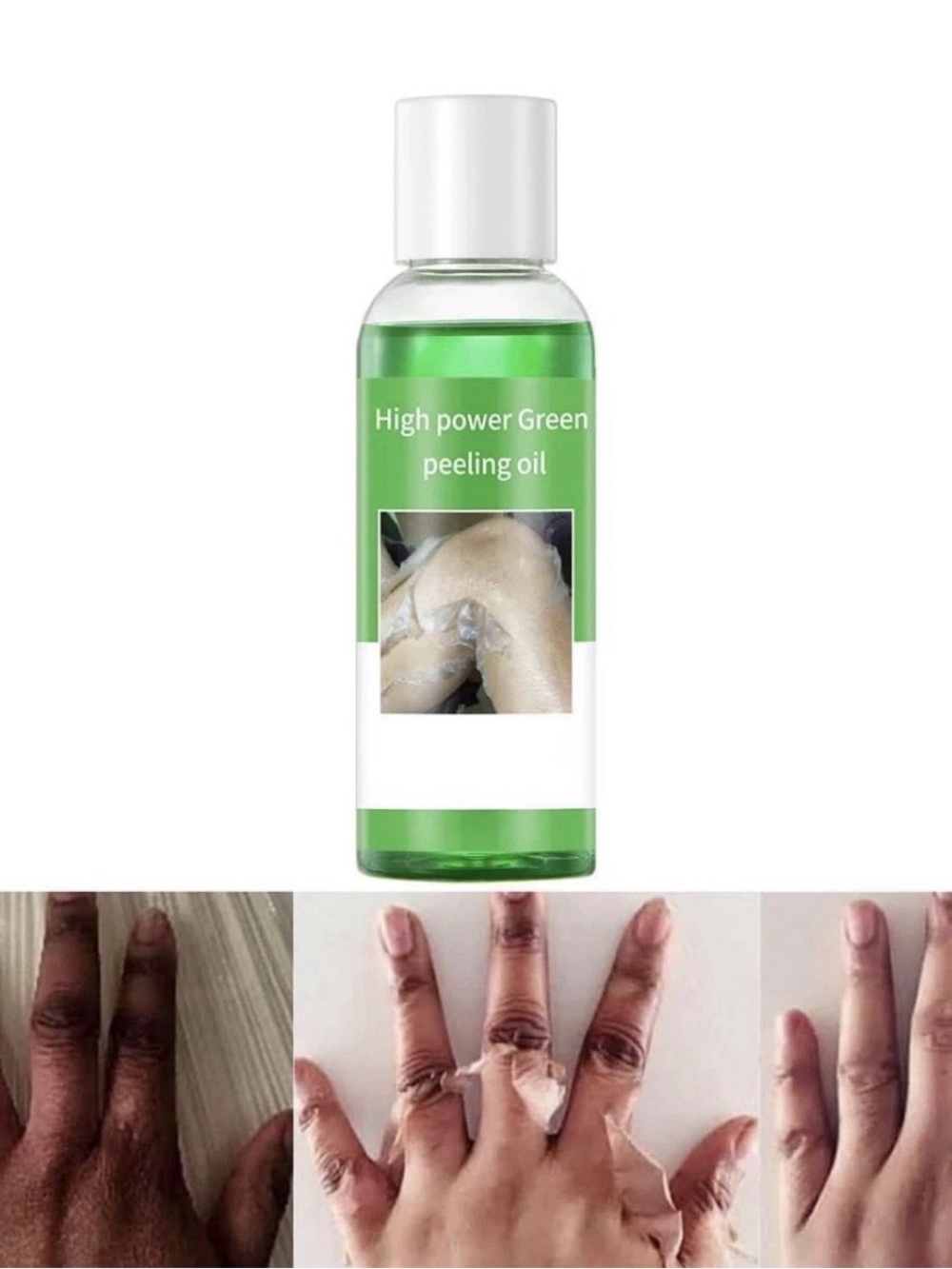 Peeling Oil for Dark Skin, Green Oil, Facial 3.52 Fl Oz